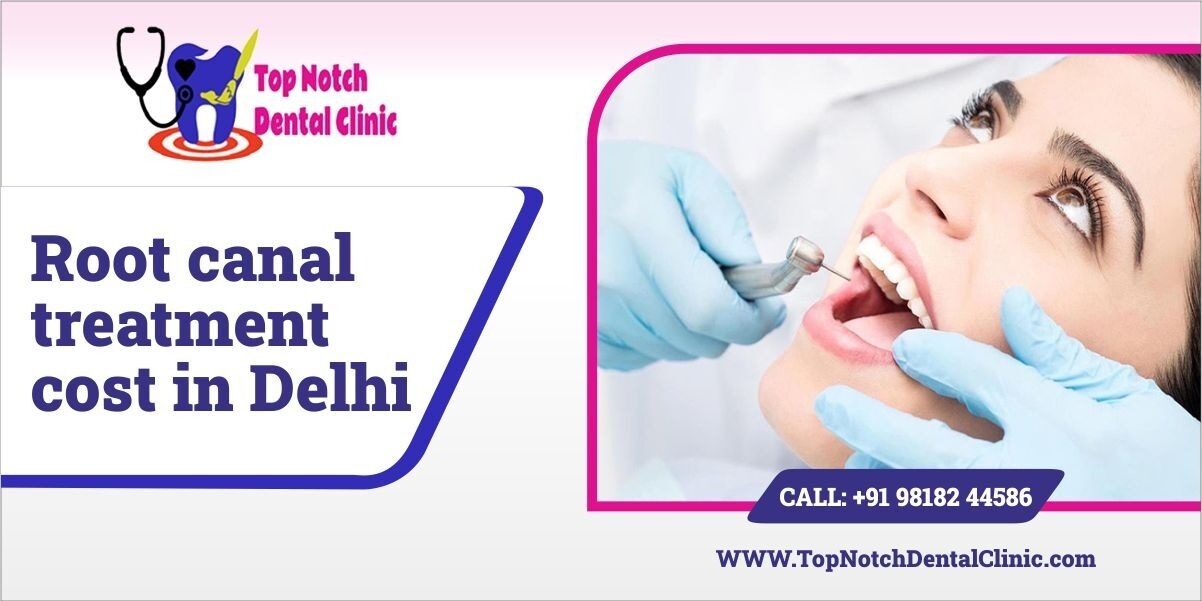 Root Canal Treatment Cost in Delhi